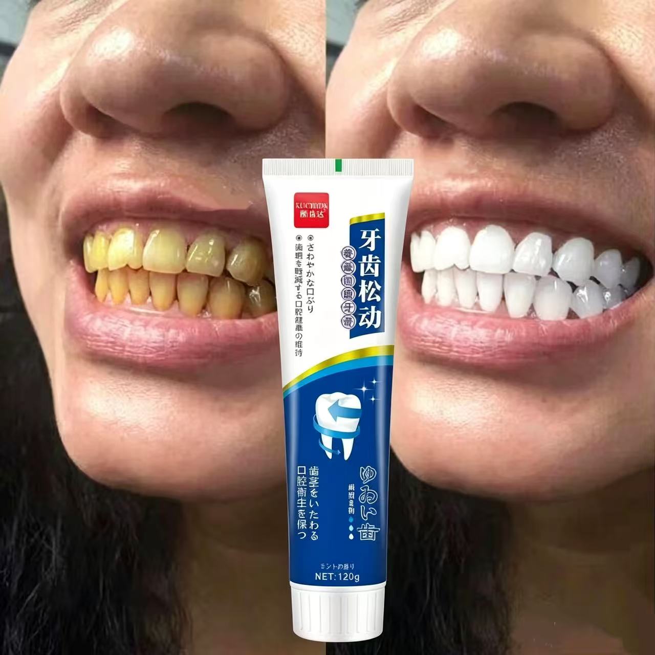 Teeth Whitening Japanese - Fix Loose Teeth Japanse geïmporteerde tandpasta