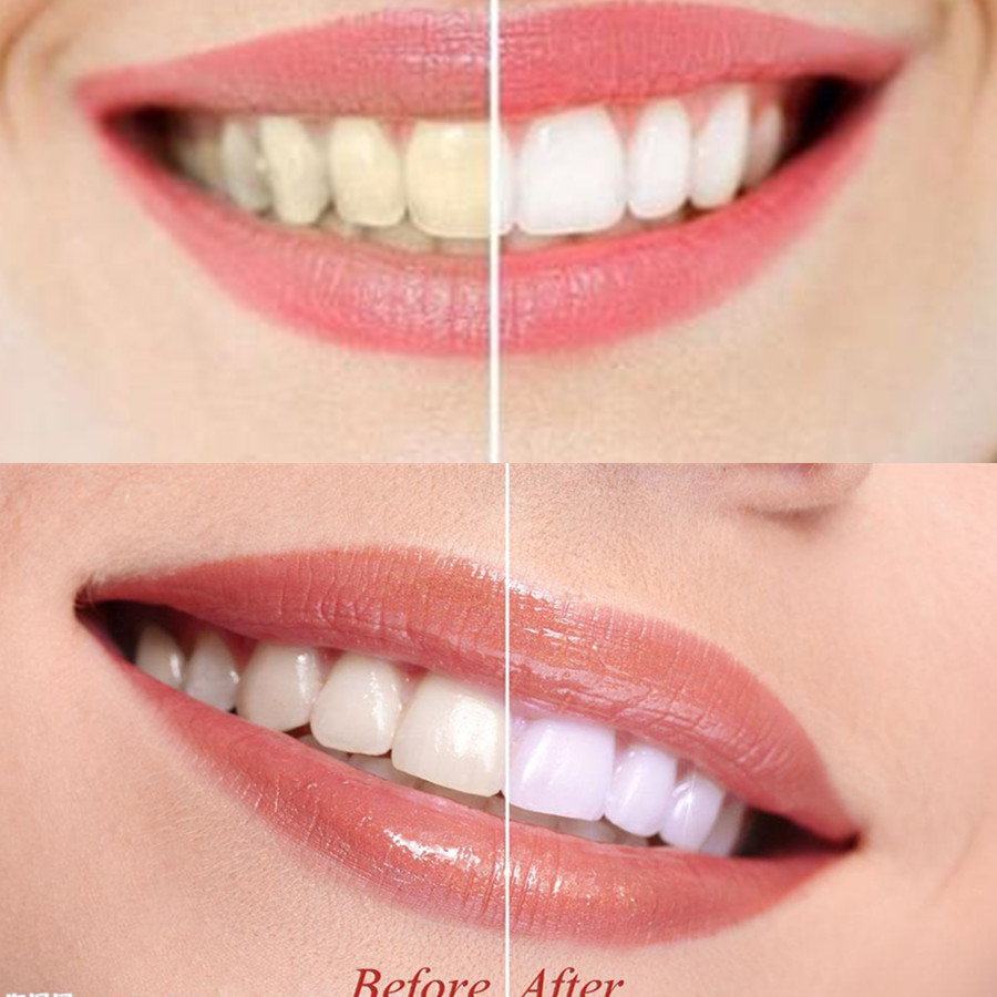 Bamboe Houtskool Tanden Dental - Teeth Whitening Co recensie en prijs