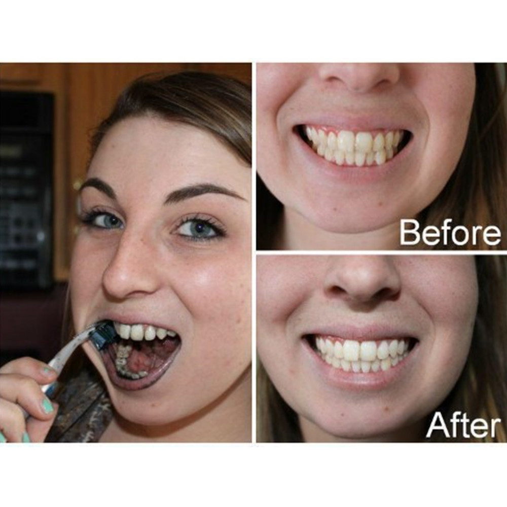 Bamboe Houtskool Tanden Dental - Teeth Whitening Co recensie en prijs