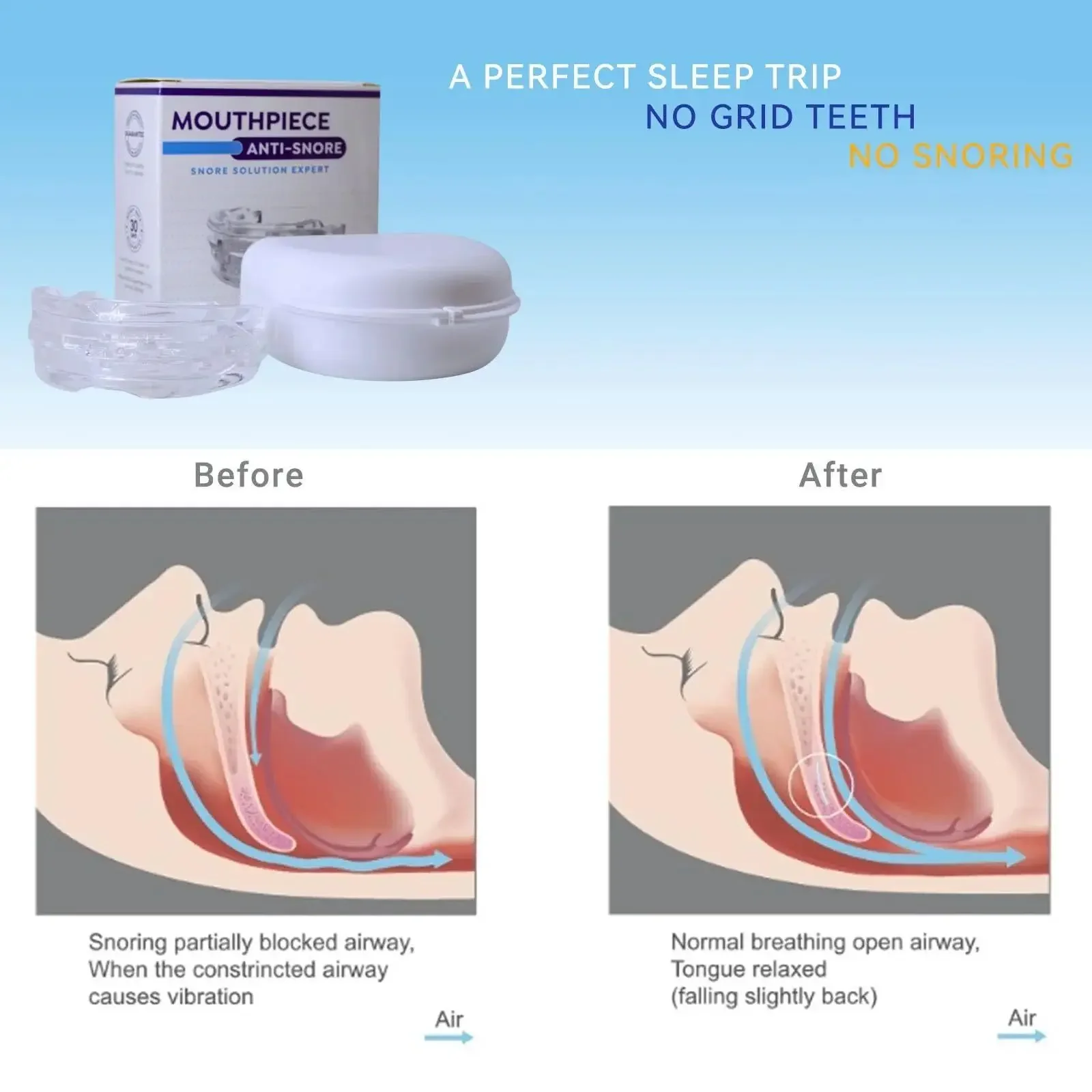 Verstelbare anti-snurk mondbes - Dental Guard Night recensie en prijs