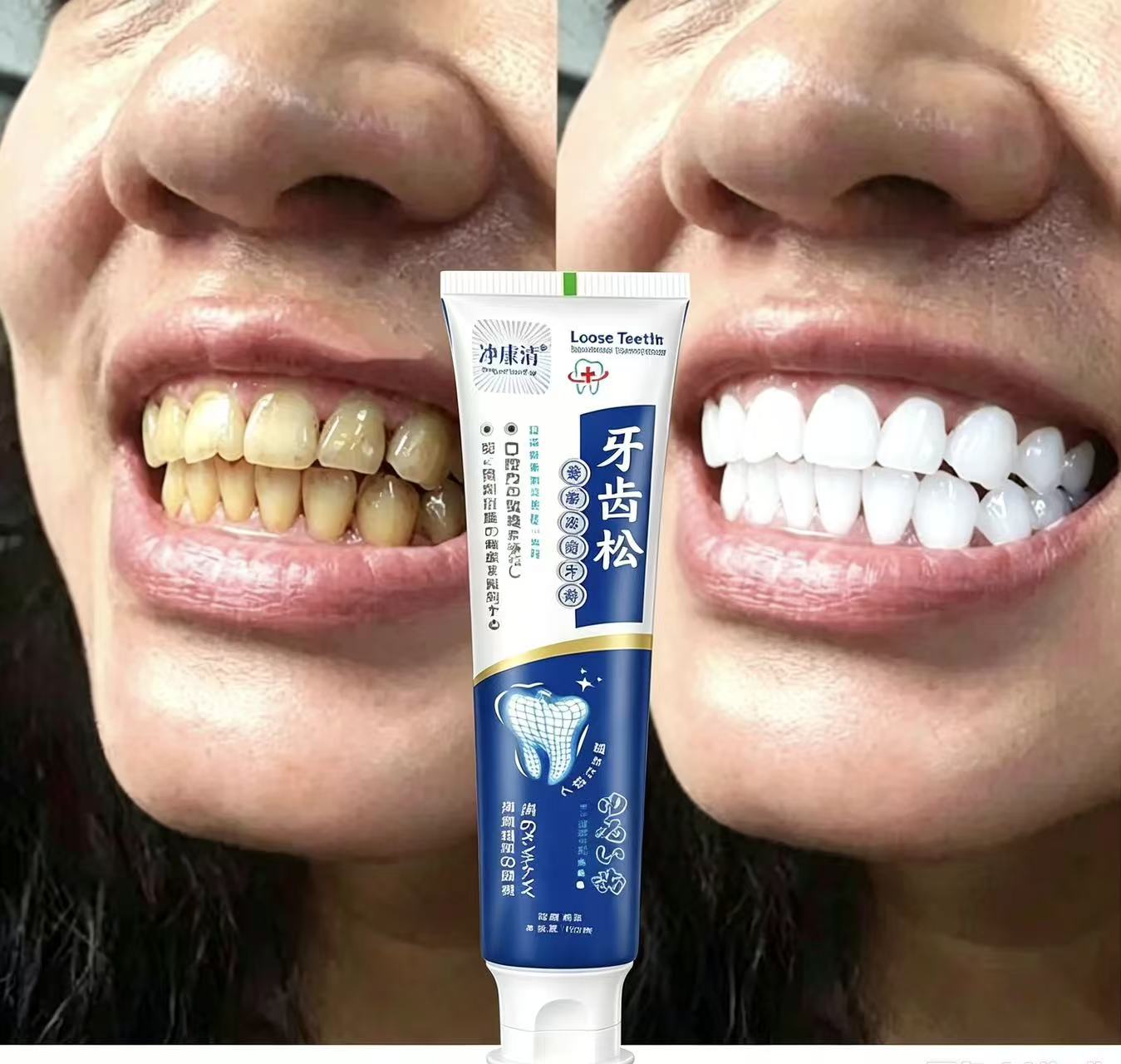 Fix Loose Teeth Japanse geïmpo - Teeth Whitening Japanese recensie en prijs