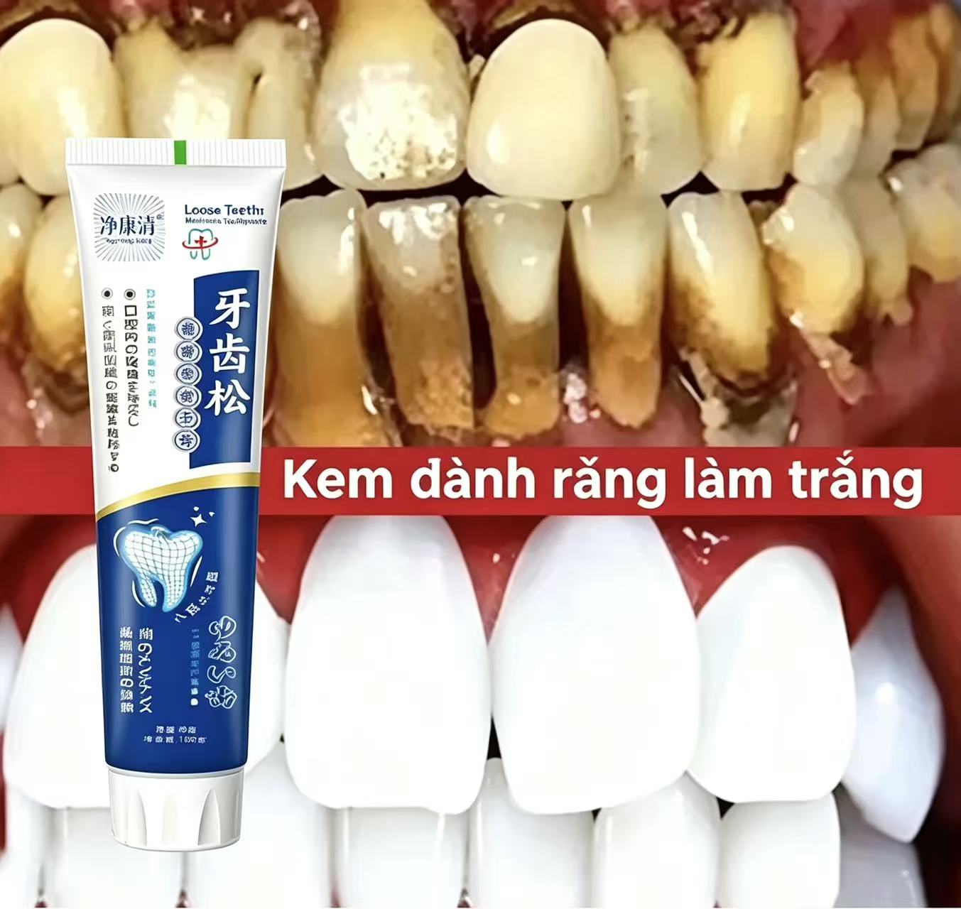 Fix Loose Teeth Japanse geïmpo - Teeth Whitening Japanese recensie en prijs