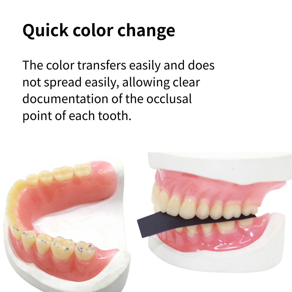 AG 300 Vel/Doos Tandheelkundig - Teeth Whitening Lab recensie en prijs