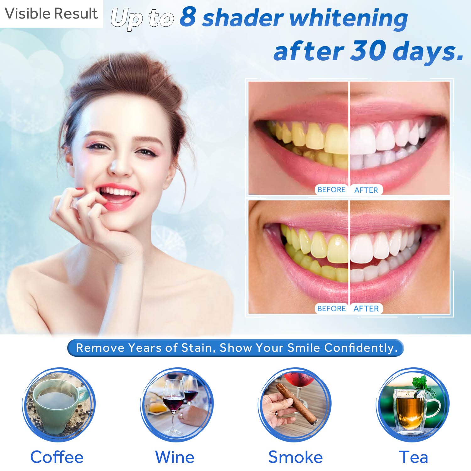 Tanden Whitening Gel Refill Sp - Colgate Whitening Teeth recensie en prijs
