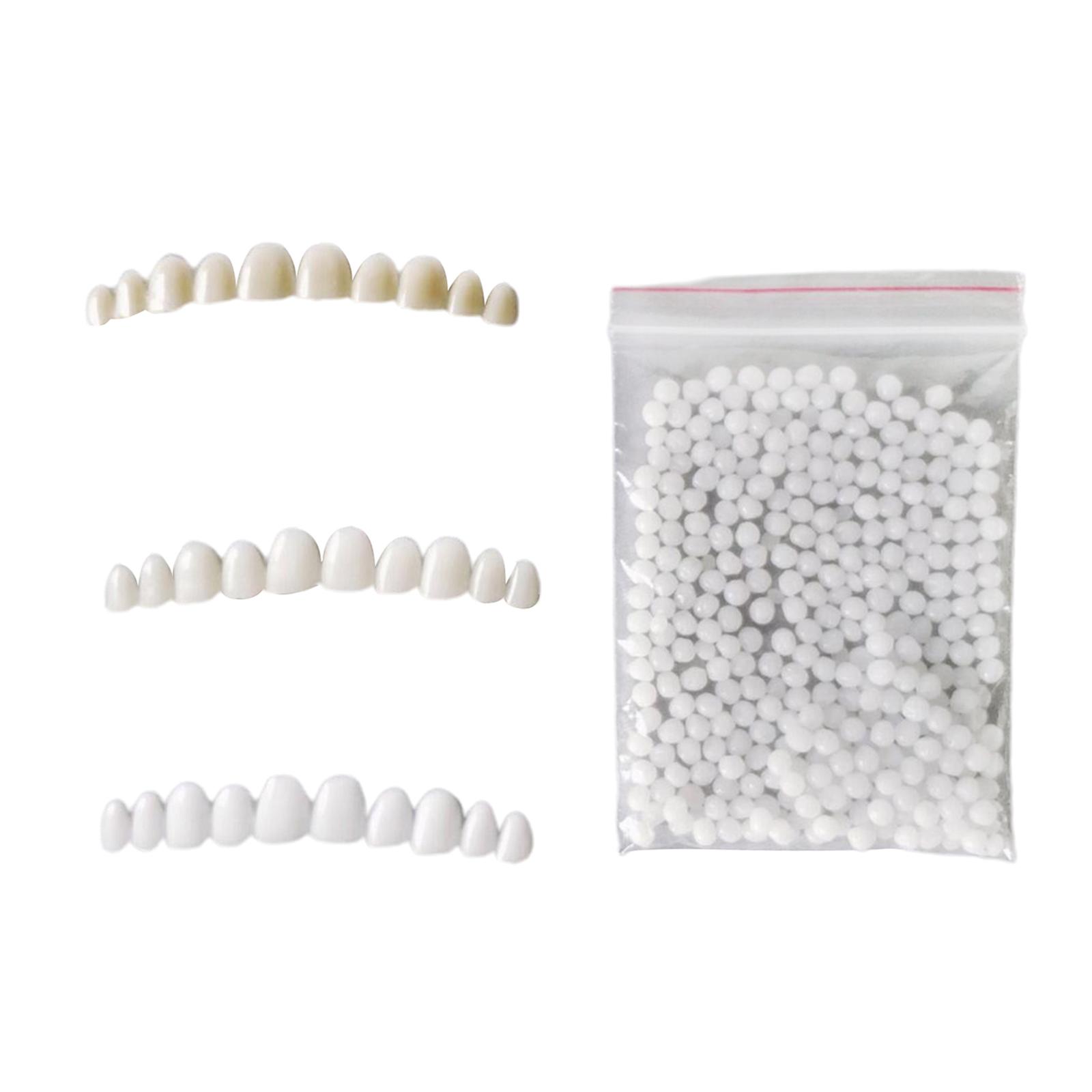 Tijdelijke tandenbleekset met  - Teeth Whitening At Home Kit recensie en prijs