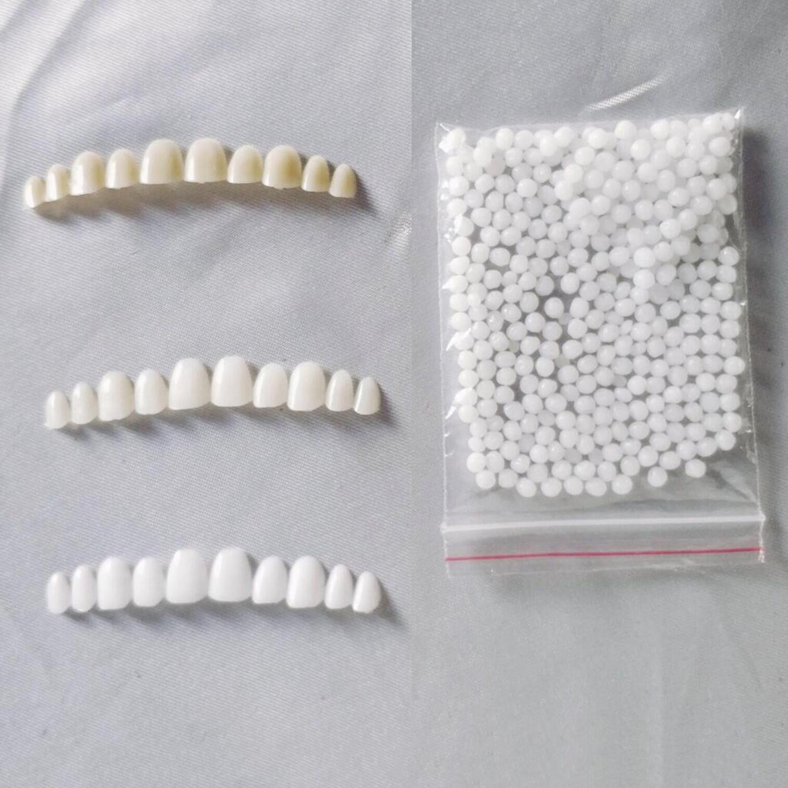 Tijdelijke tandenbleekset met  - Teeth Whitening At Home Kit recensie en prijs