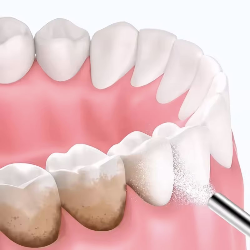 130g Tandbleekpoeder voor zand - Teeth Whitening Co recensie en prijs