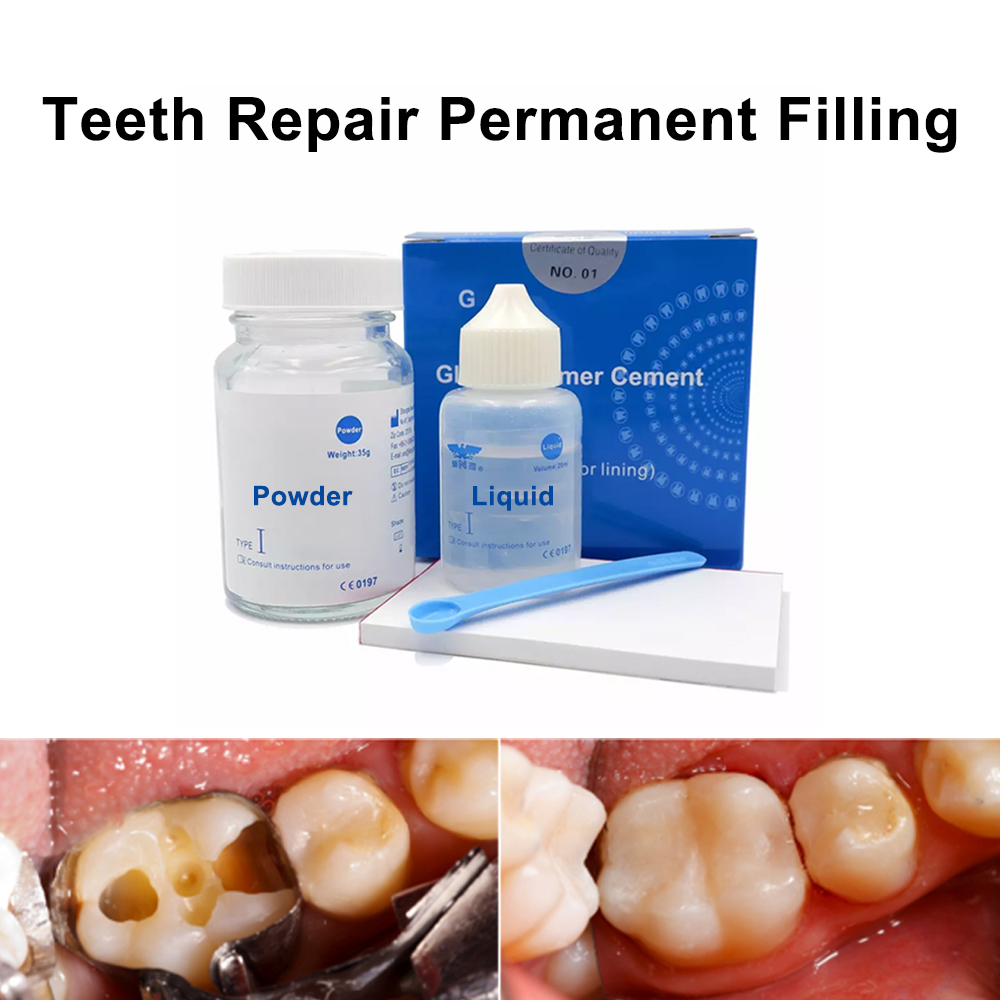 Permanente Tanden Vullen Repar - Teeth Whitening At Home Kit recensie en prijs