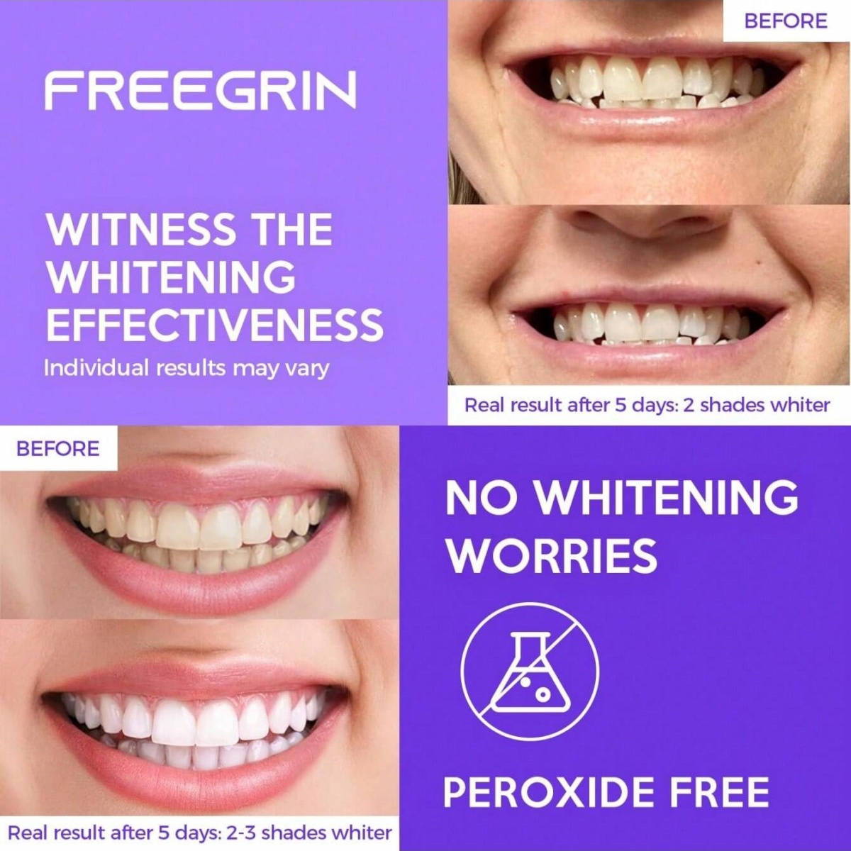 Deluxe Tanden Whitening Sticke - Teeth Whitening Gel Refills recensie en prijs