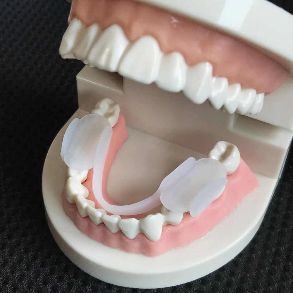 2 Stuks Tanden Spalk Protector - Dental Guard Night recensie en prijs
